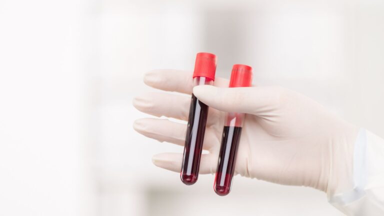 Serumcu: Understanding the Vital Liquid Component of Blood