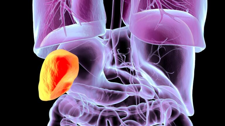 Adenoidid: The Role of Adenoids in Immune Defense and Childhood Health