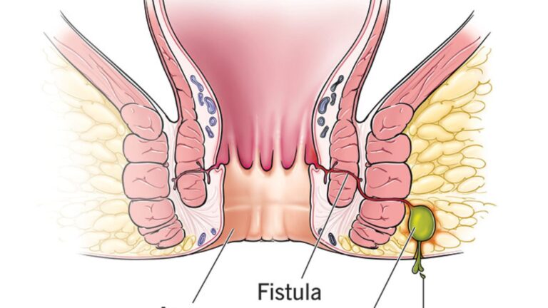 Fisila: Understanding Abnormal Connections in the Human Body Fisila: Understanding Abnormal Connections in the Human Body